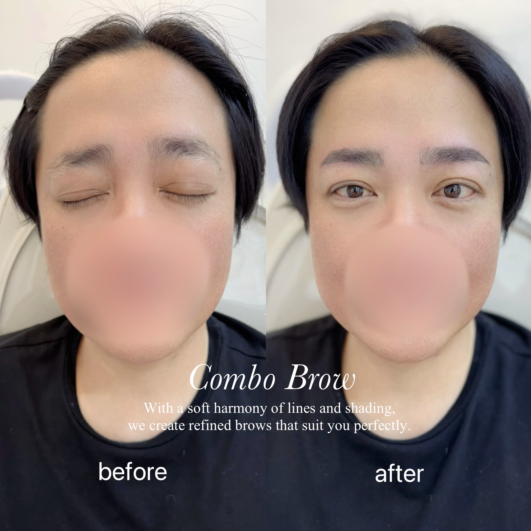 Combo Brow 비포애프터