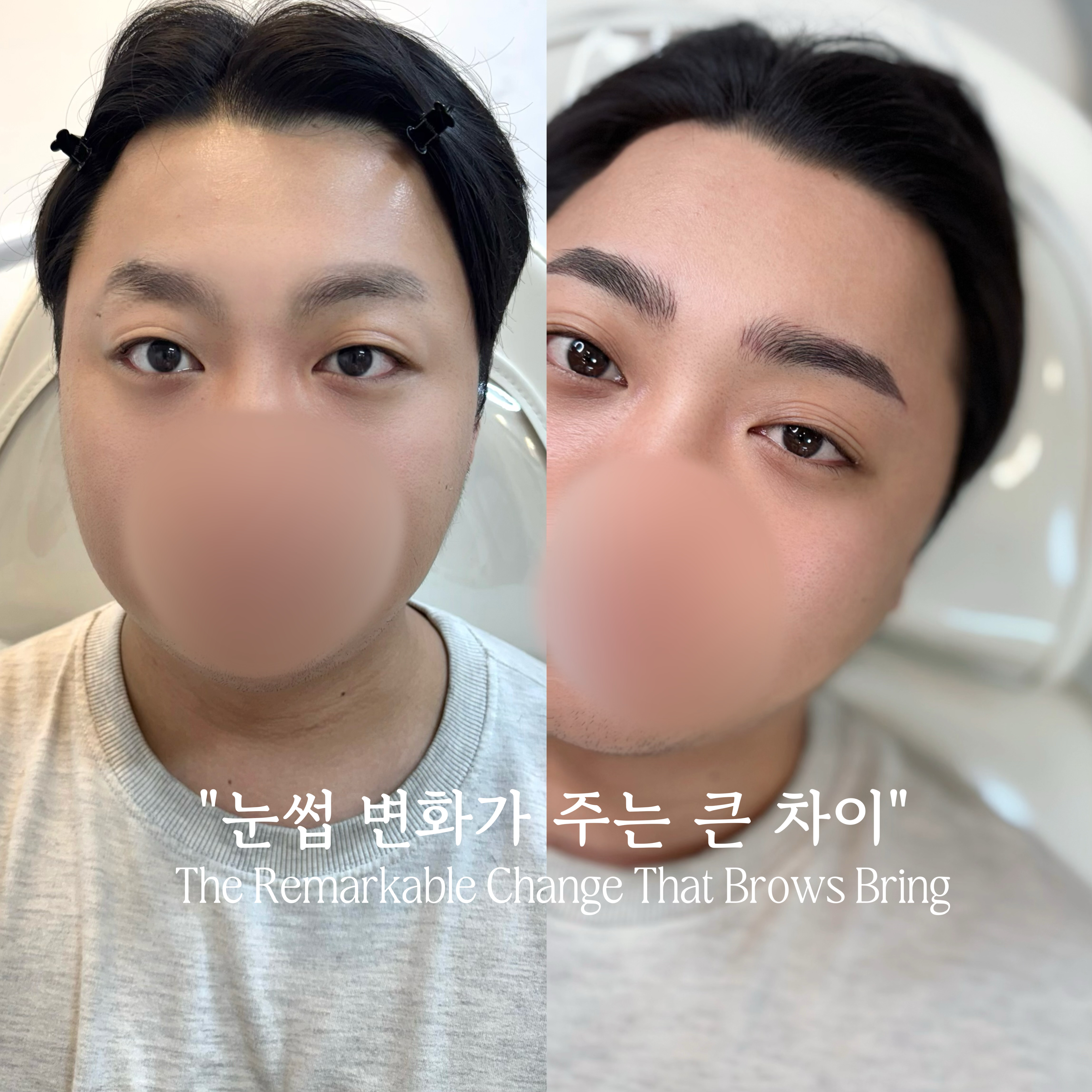 남성 눈썹 비포애프터