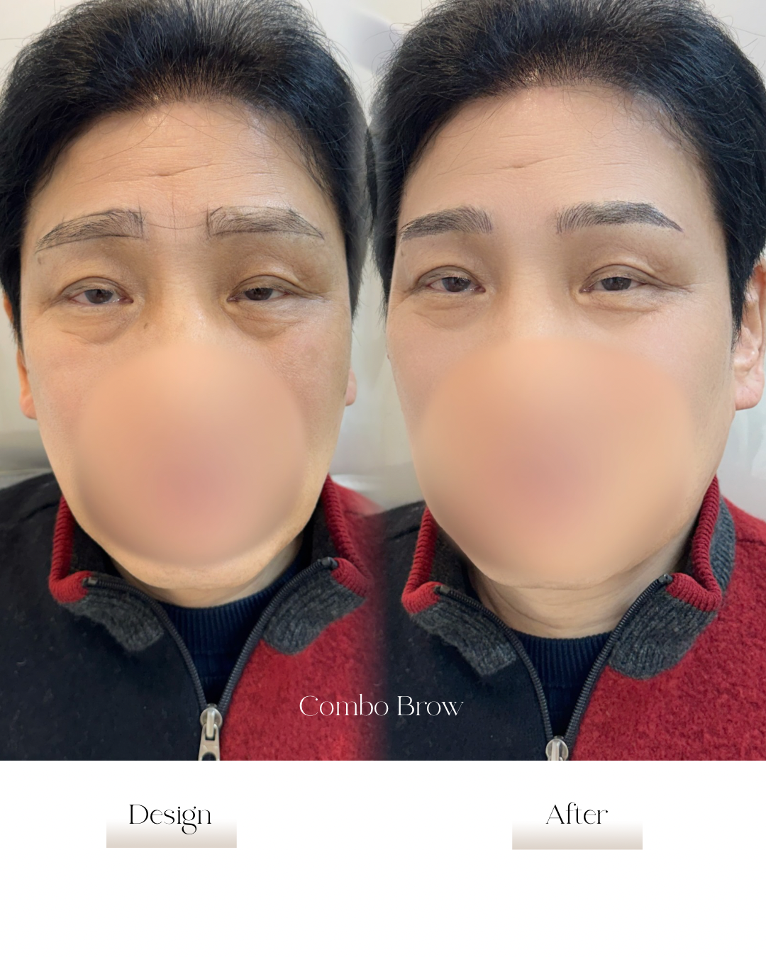 남성 Combo Brow 비포애프터