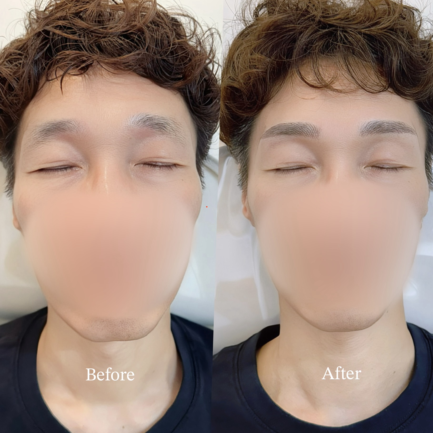 남성 눈썹 비포애프터