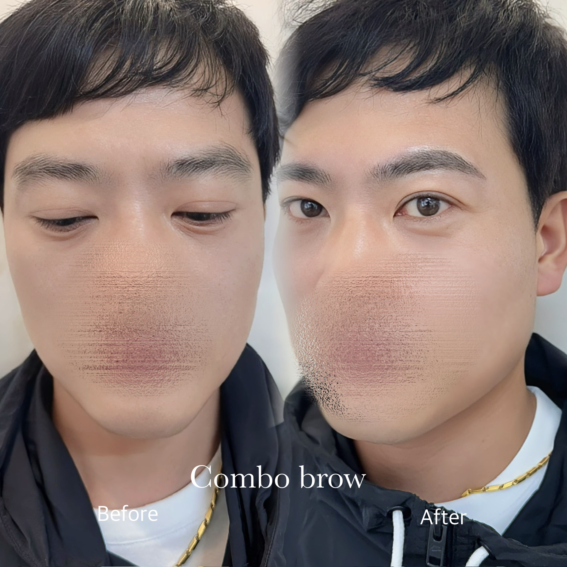남성 Combo Brow 비포애프터